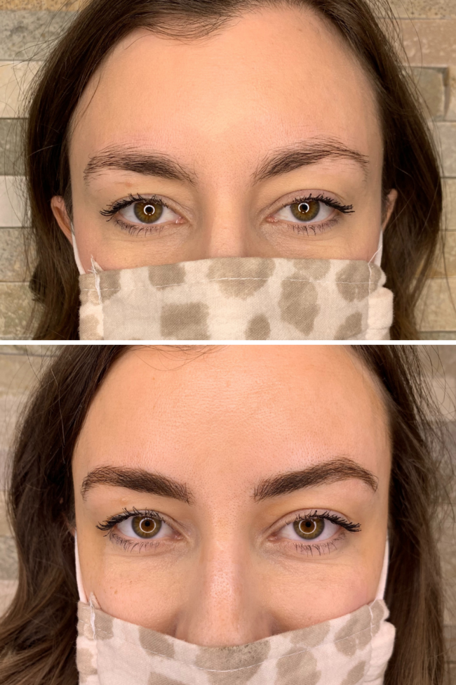 Microblading eyebrows before and after | I'm sharing the entire microblading process - from start to finish (including progress pictures while my eyebrows heal!) | Plus, a Q & A with the microblading artist! | Kansas City life, home, and style blogger Megan Wilson shares her microblading experience (@shadylaneblog on Instagram)